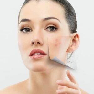 Acne and spot Care